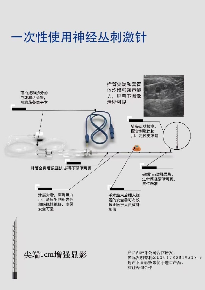 神经丛刺激针的治疗过程是怎样的？