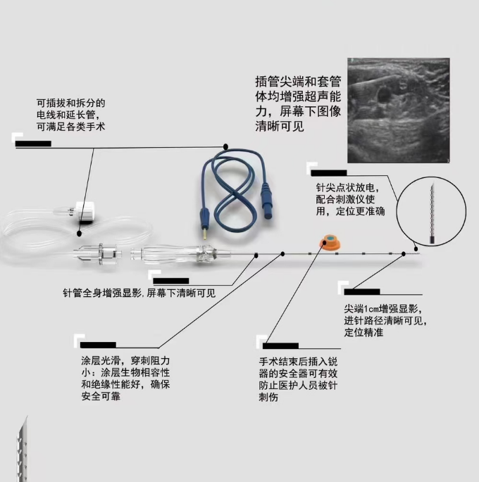 使用神经丛刺激针的感受探索